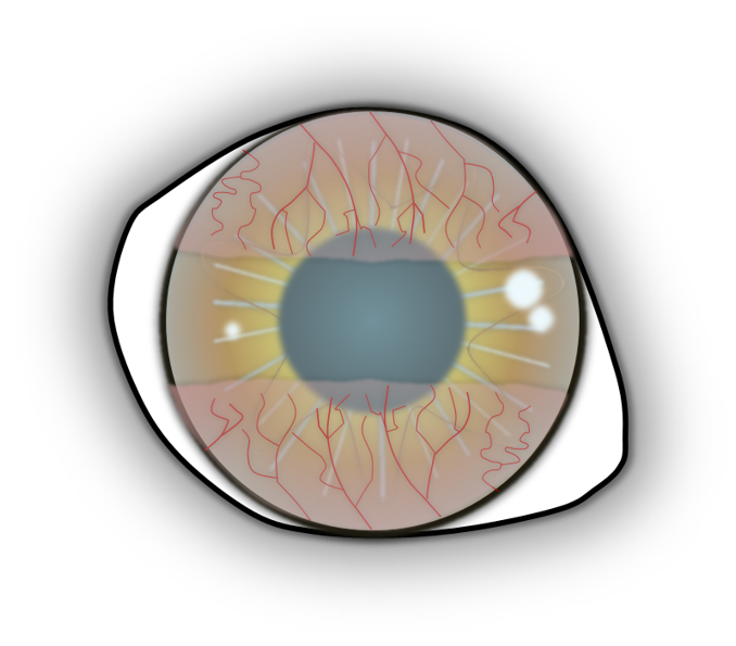 Auge dünnem Bindehauttransplantat im oberen und unteren Drittel