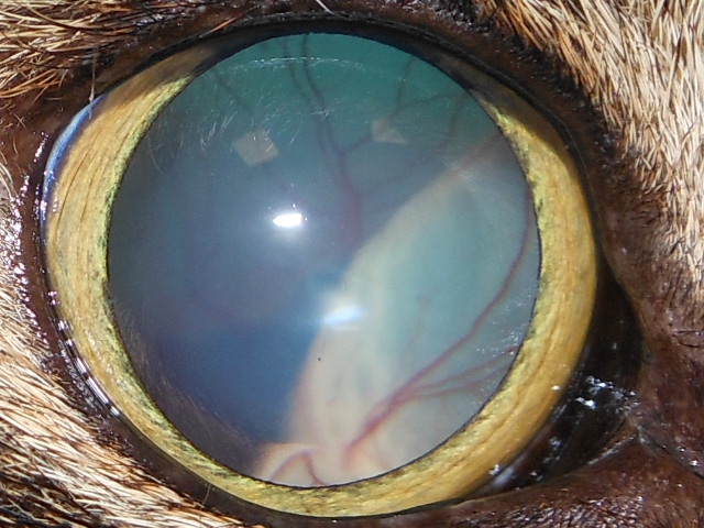 Augenfoto mit weiter Pupille. In der Pupille ist als Falten mit Blutgefäßen die abgelöste Netzhaut erkennbar.
