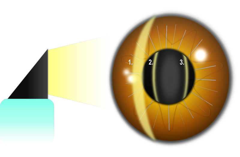 Ein Grafik eines Auges stellt die Brechung des Spaltlichtes an den einzelnen Strukturen dar.