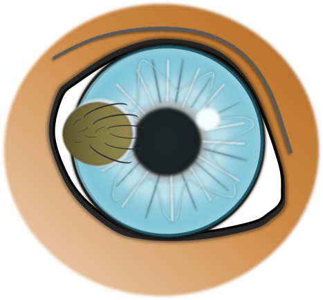 Dermoid