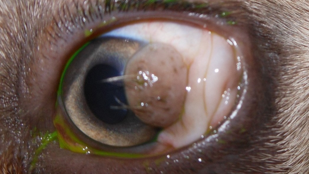 Dermoid