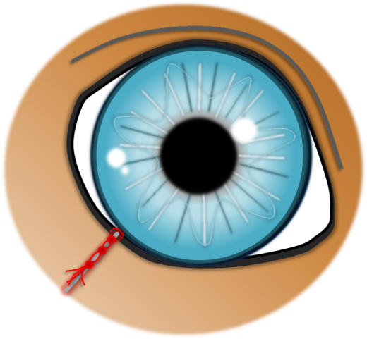 Lidrandtumor-OP