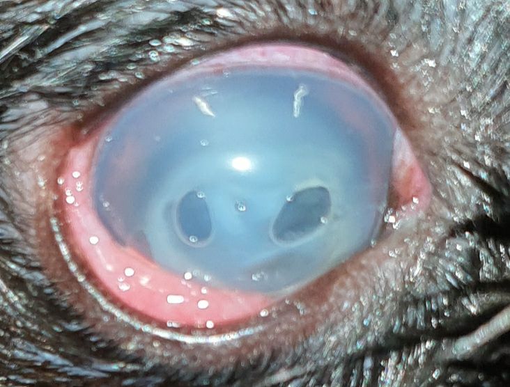 einschmelzendes Ulcus mit Kollagenlinse